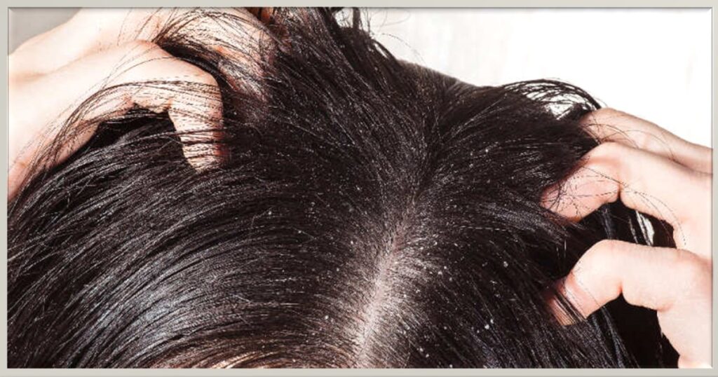 what are the benefits of rice water for hair