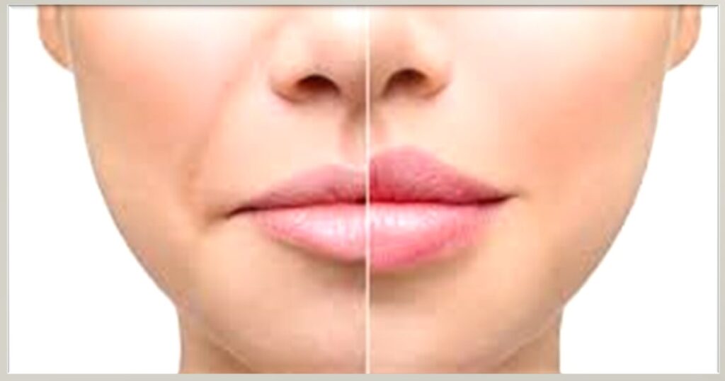 how to make your lips look bigger naturally
